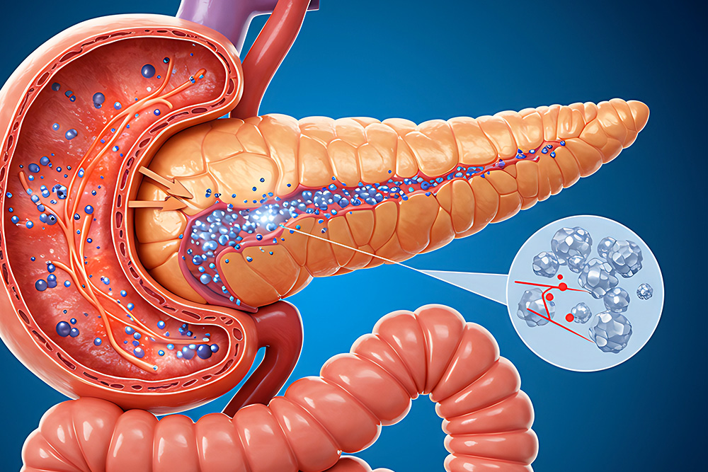 Epidémiologie pancréas
